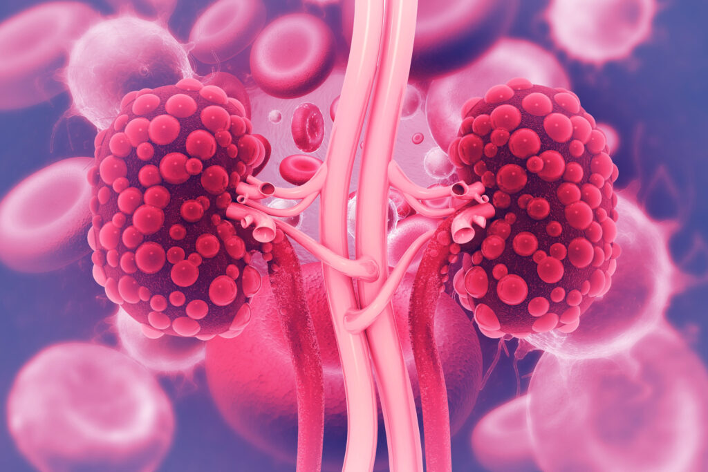 Kidney disease. 3d illustration