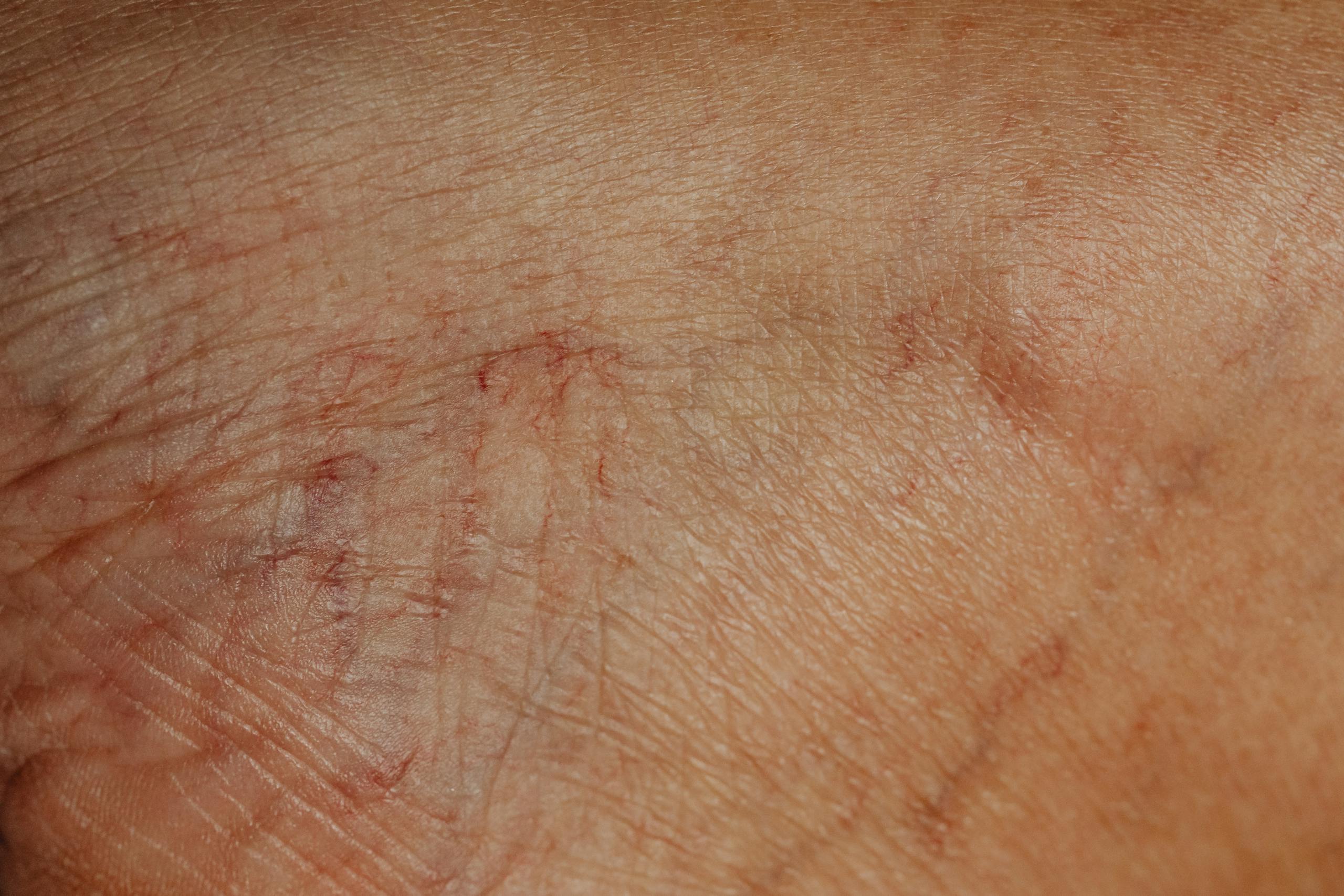 Detailed close-up image highlighting the texture and wrinkles of aging human skin.