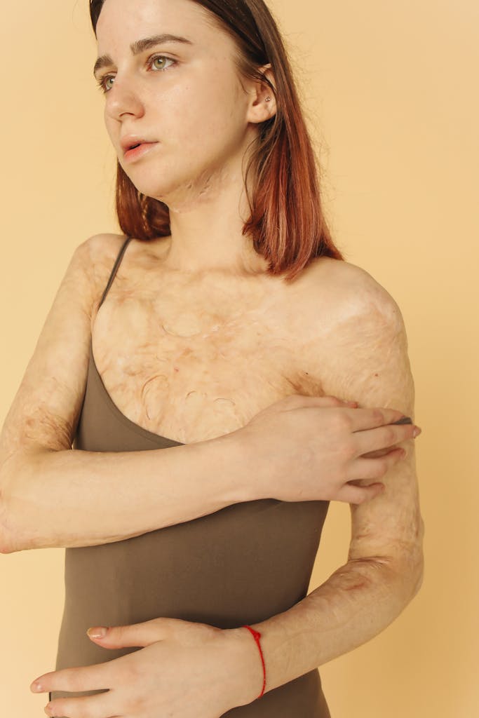 Empowering image of a woman embracing her scars, symbolizing strength and resilience.