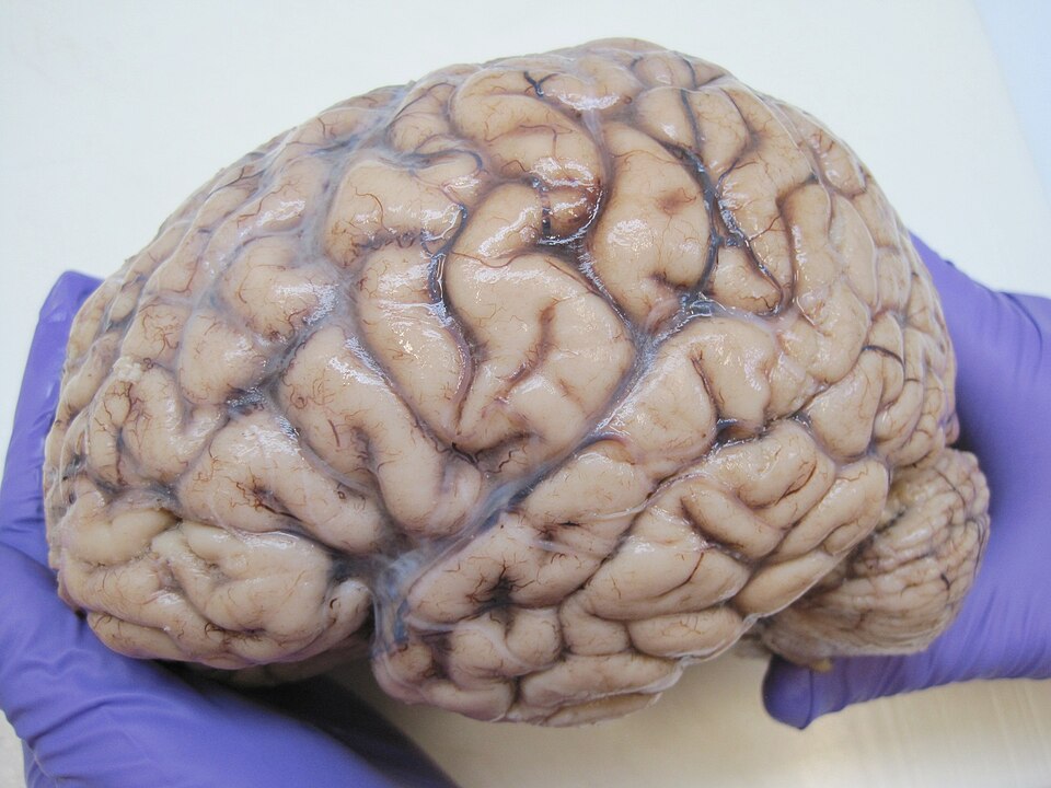 7 Daily Habits That Quietly Drain Your Brain Power